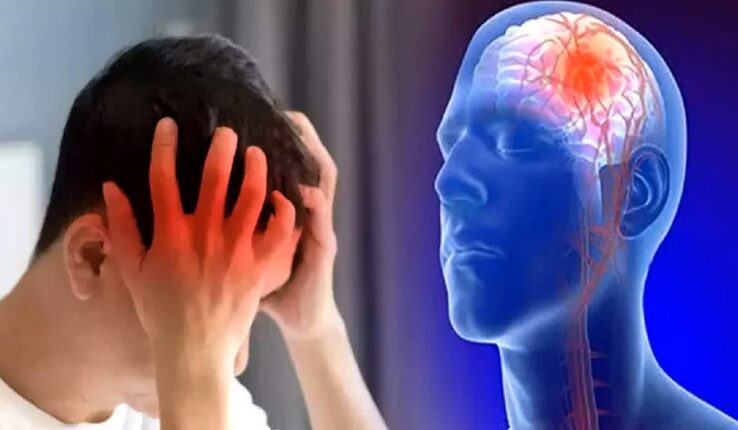 Ifata abato n’abakuze: Byinshi ku ndwara ya “Stroke” yica cyane